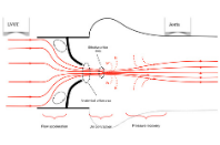 Aortic stenosis eLearning module